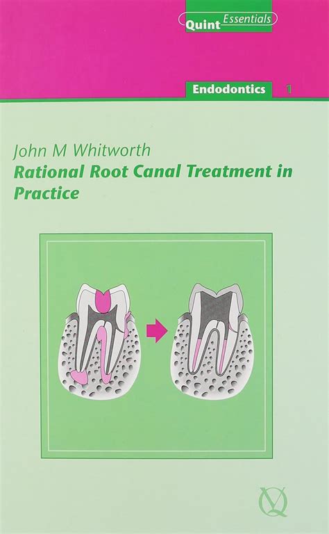 download Rational Root Canal Treatment in Practice